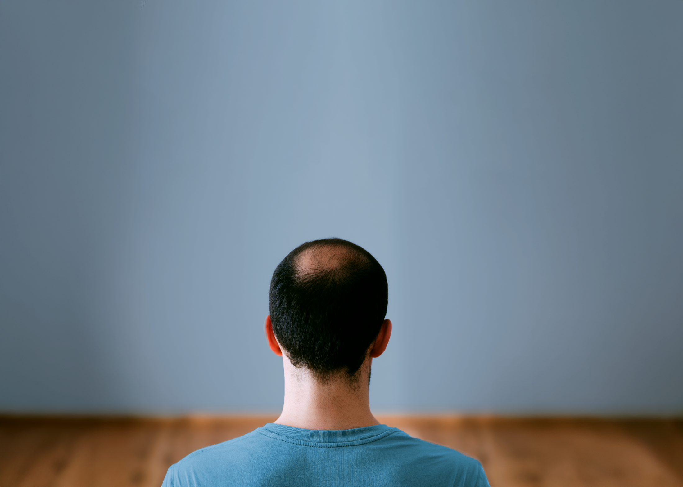 Man with visible hair thinning viewed from behind